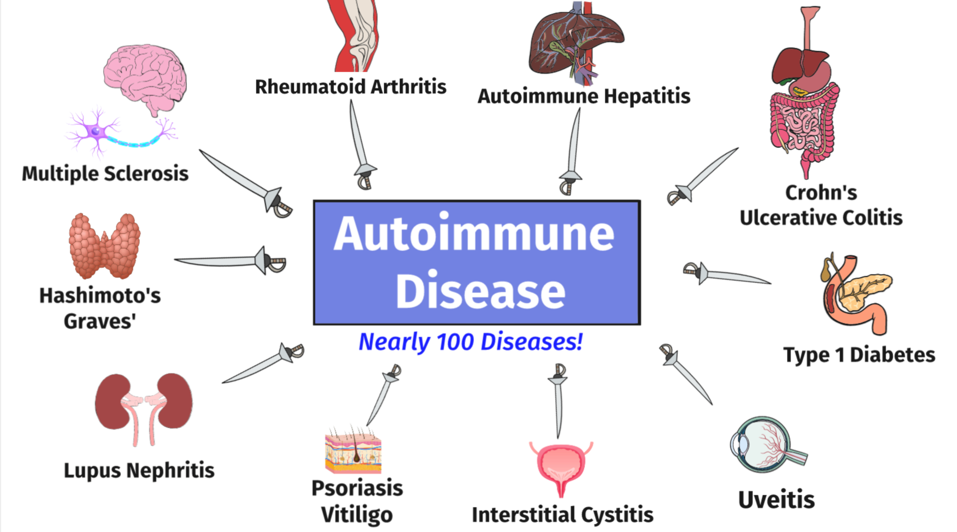 The New Pandemic: Autoimmune Diseases